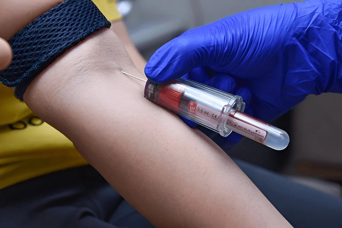 Close-up of a painless blood draw with vacutainer