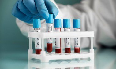 Barcoded blood test tubes arranged in a rack for analysis